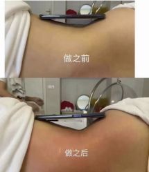 点击看大图 -Lily纤美·科技减脂中心