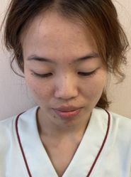 -北京米扬丽格医疗美容·联合丽格鼻整形中心