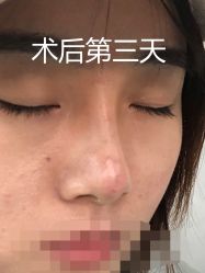 -八大处整形