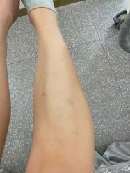 -MUSES专业脱毛日式比基尼サロン连锁
