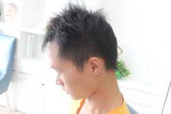 点击看大图 -大麦微针植发丨全国连锁