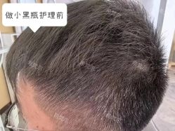 -希梵尔头皮抗衰·科技养发