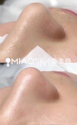 -韩国淼美颜皮肤管理官方直营店