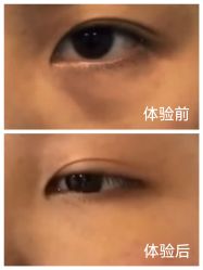 -Yestar宁波艺星整形医院