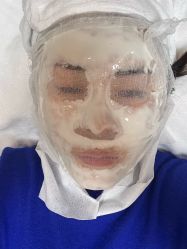 -蚌埠国色医疗美容医院•眼鼻整形