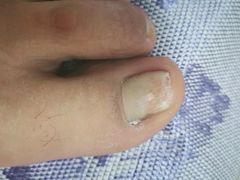 -郑远元专业修脚房(枋湖路店)