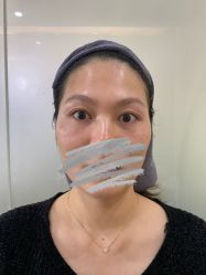 -天津健丽·去眼袋医疗美容机构