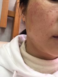 体验后-深圳美莱医疗美容医院