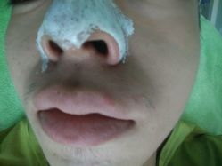 点击看大图 -苗医生草本科技祛痘