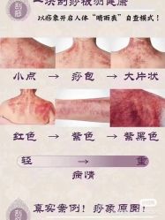 -香薇妮丝女子减肥院