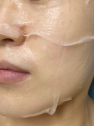 -圣嘉新医疗美容医院