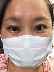 体验后-金圣医疗美容
