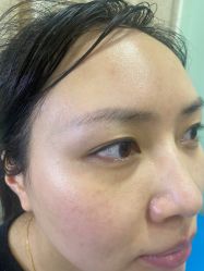 点击看大图 体验前-重庆联合丽格第五医疗美容医院