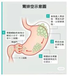 -香薇妮丝女子减肥院