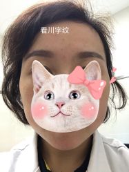 体验后-重庆军美医疗美容医院