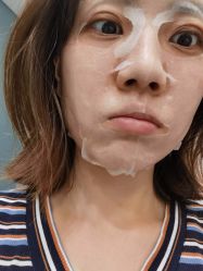 体验后-美瑞莎创美医疗美容