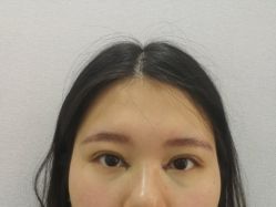-八大处整形
