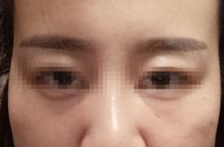 体验前-新美荟医美·专注面部美学抗衰
