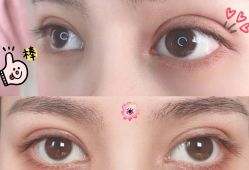 -联合丽格·张菡丽格医疗美容