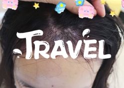 -大麦微针植发全国连锁