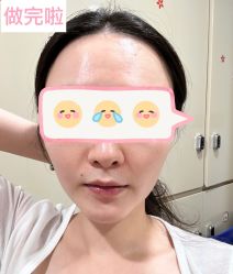 体验后-上海时光整形外科医院