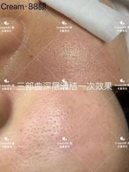 -Cream88颜皮肤管理中心