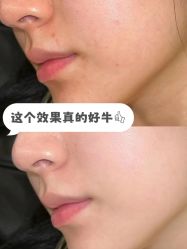 -EC BEAUTY易思美容