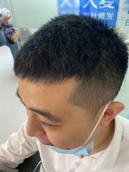 -大麦微针植发全国连锁
