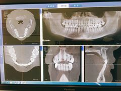 -Dr.Z dental仁康种植矫正中心