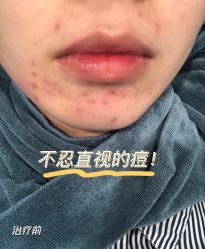 体验前-郑荃丽格医疗美容