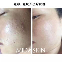 -MIDA蜜哒•科技逆龄美肤连锁
