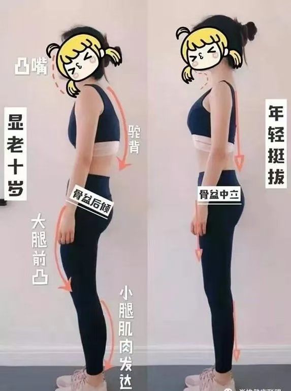 骨盆后倾