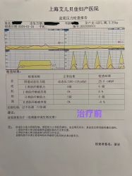 -上海艾儿贝佳妇产科医院