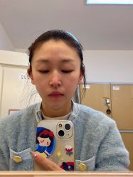 体验前-圣嘉新医疗美容医院