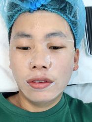 -悟空祛痘·诺奖技术专业店