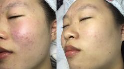 -Cream88颜皮肤管理中心