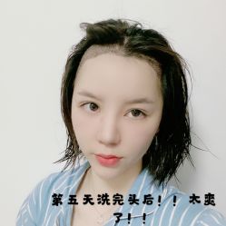 -碧莲盛·不剃发植发