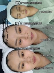 -叶美人医疗美容