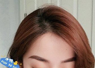 -大麦微针植发丨全国连锁