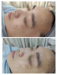 -SKIN79皮肤管理中心