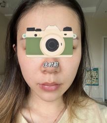 体验前-亿美医疗美容·半岛大超炮官方授权店