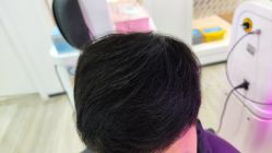 -雍禾植发全国连锁