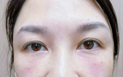 -天津健丽·去眼袋医疗美容机构