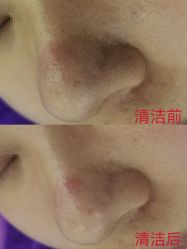-蕾特恩专业祛痘·皮肤管理