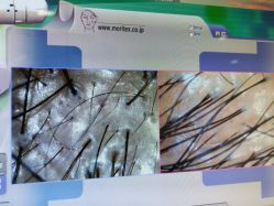 -新生植发·植养护一体