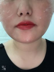 -郡艺医疗美容·微整·眼鼻吸脂