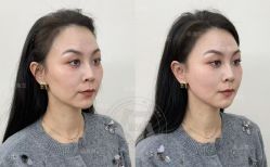 -Yestar艺星医疗美容医院
