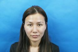 -安徽合肥韩美整形外科医院
