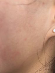 体验后-BR光电保养