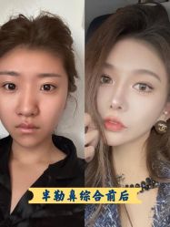 -上海伊莱美医疗美容医院